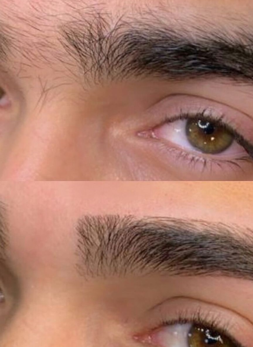 Kaş Laminasyonu Sonucu - Belirgin Kaşlar